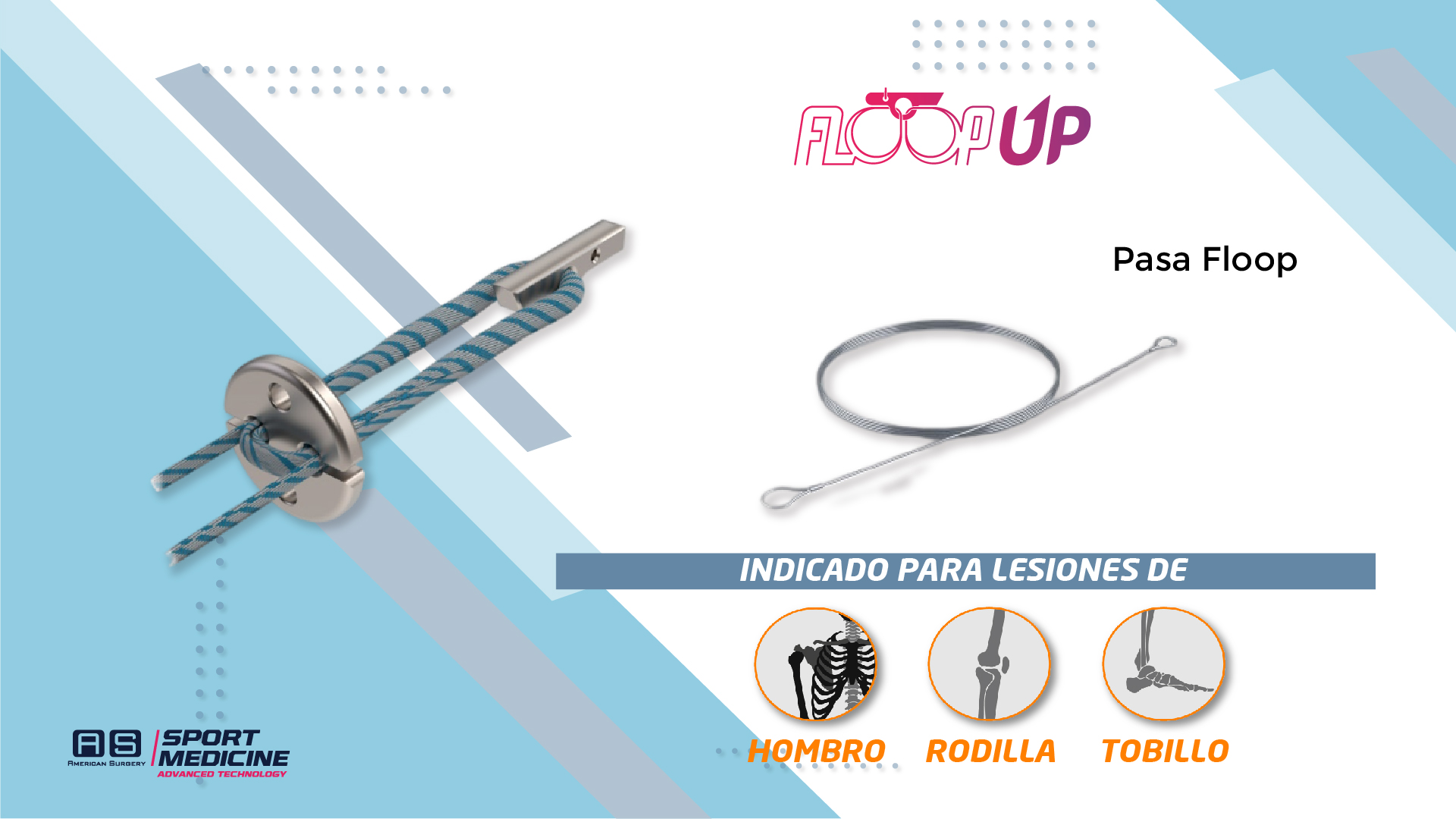 Floop – Button Loop Regulable Acromioclavicular – RH Medical